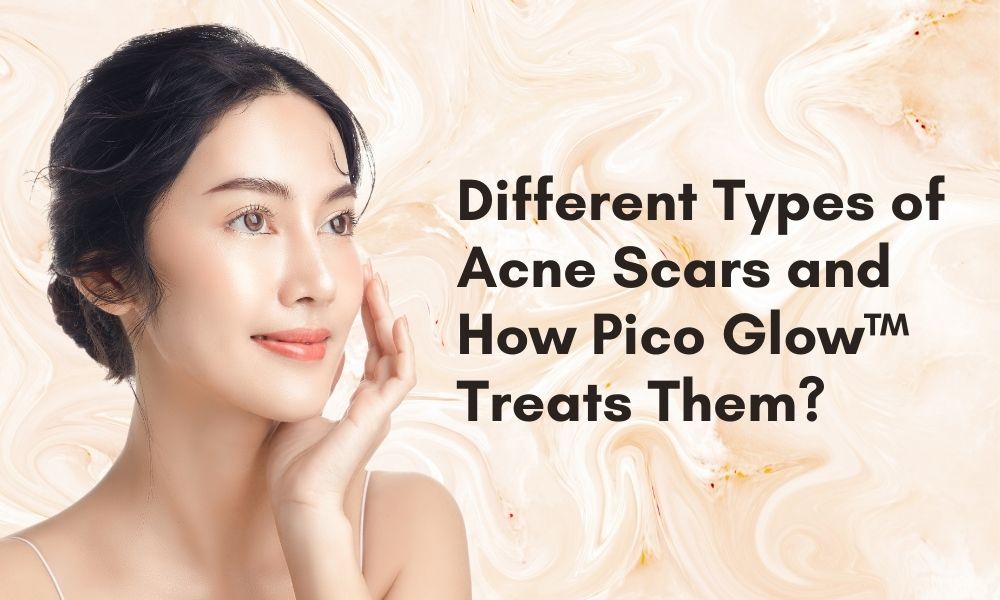 Different Types of Acne Scars and How Pico Glow™ Treats Them
