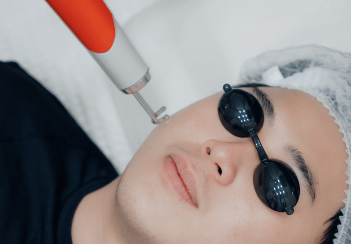 Is One Session Of Pico Laser Session Enough?