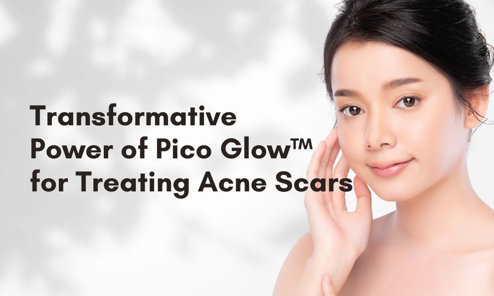 Transformative Power of Pico Glow™ for Treating Acne Scars