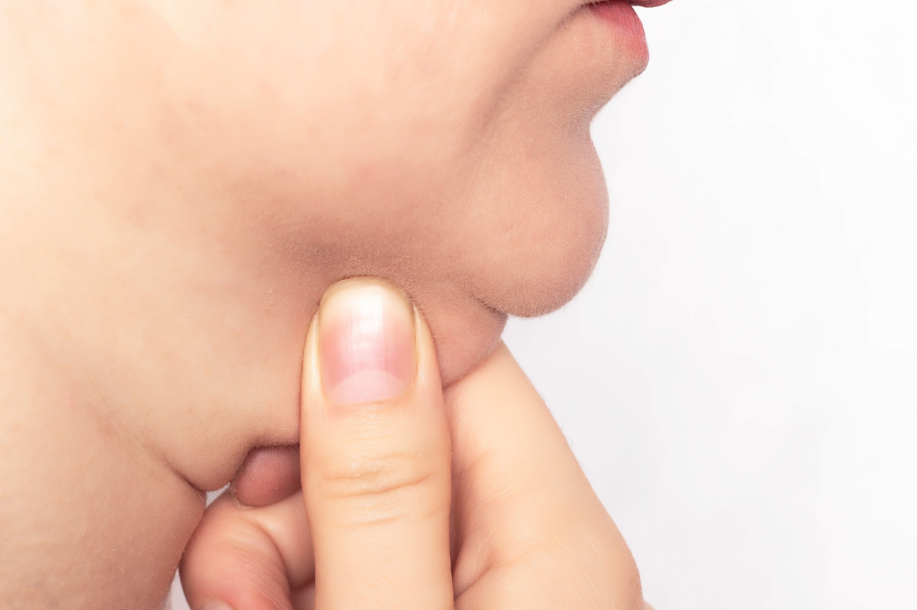 Why Do I Have Double Chin Even Though I’m Skinny?