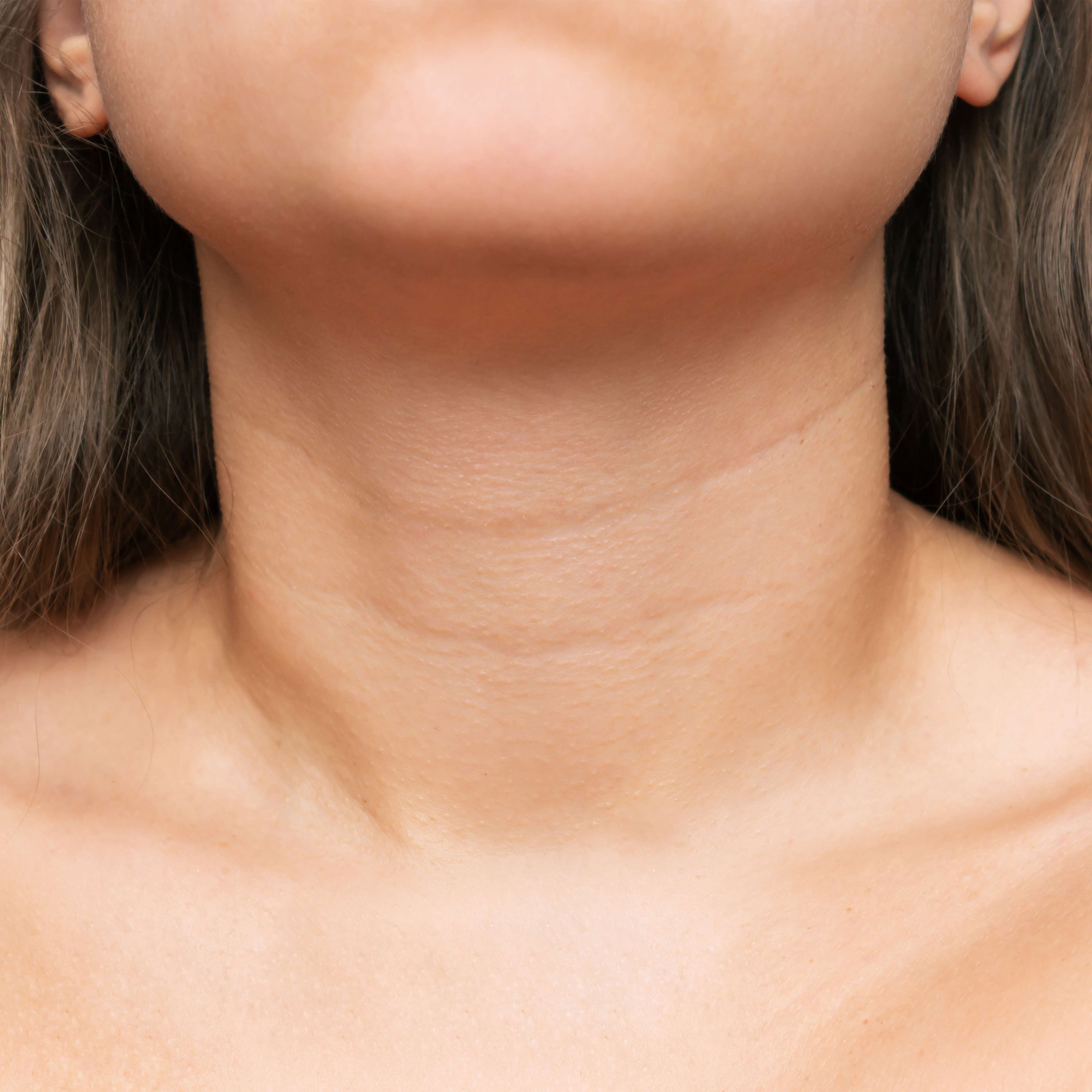 neck line