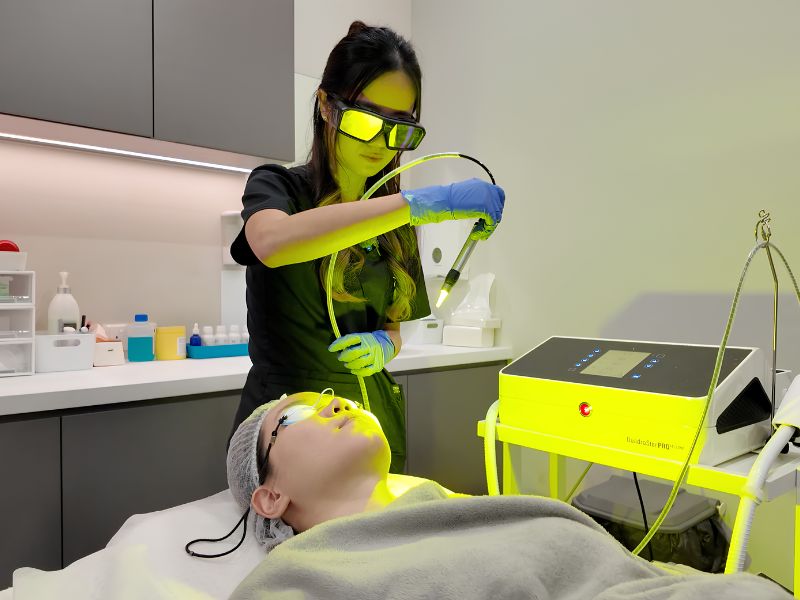 yellow laser