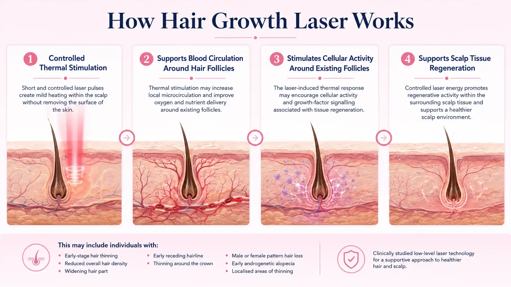 fotona hair growth mechanism