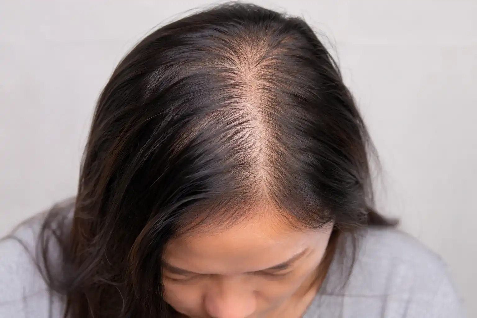 bald 2